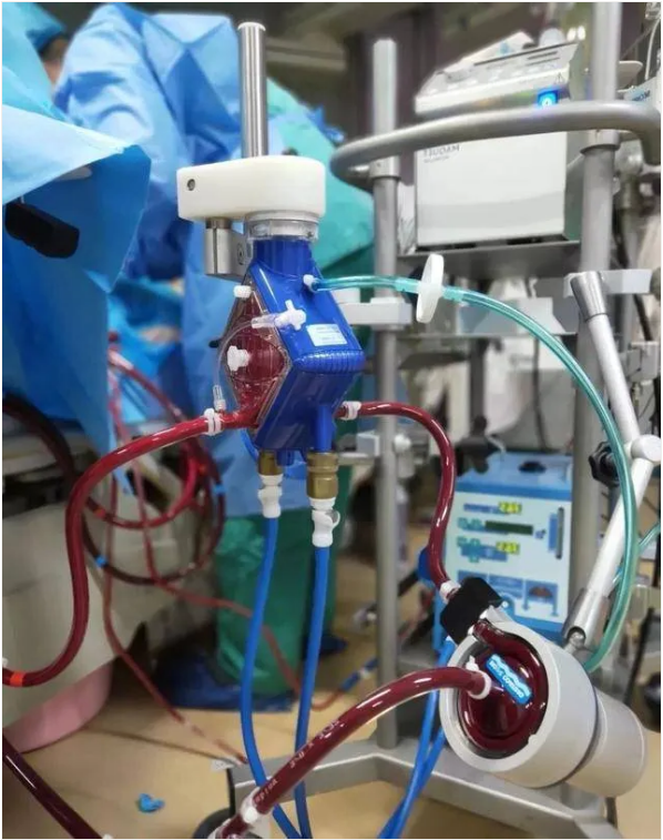 向死神要生命的ECMO：重症监护病房里的终极武器